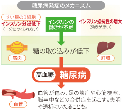 図：糖尿病発症のメカニズム