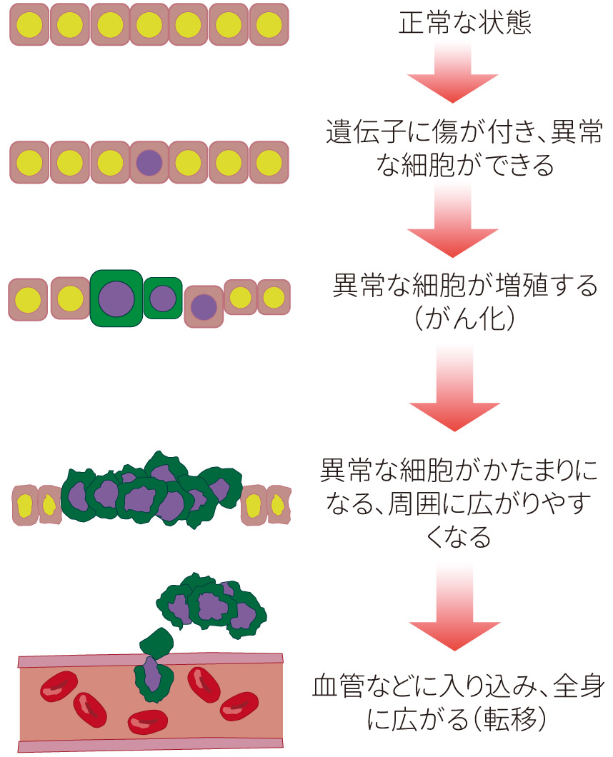 （1）正常な状態（2）遺伝子に傷が付き、異常な細胞ができる（3）異常な細胞が増殖する（がん化）（4）異常な細胞がかたまりになる、