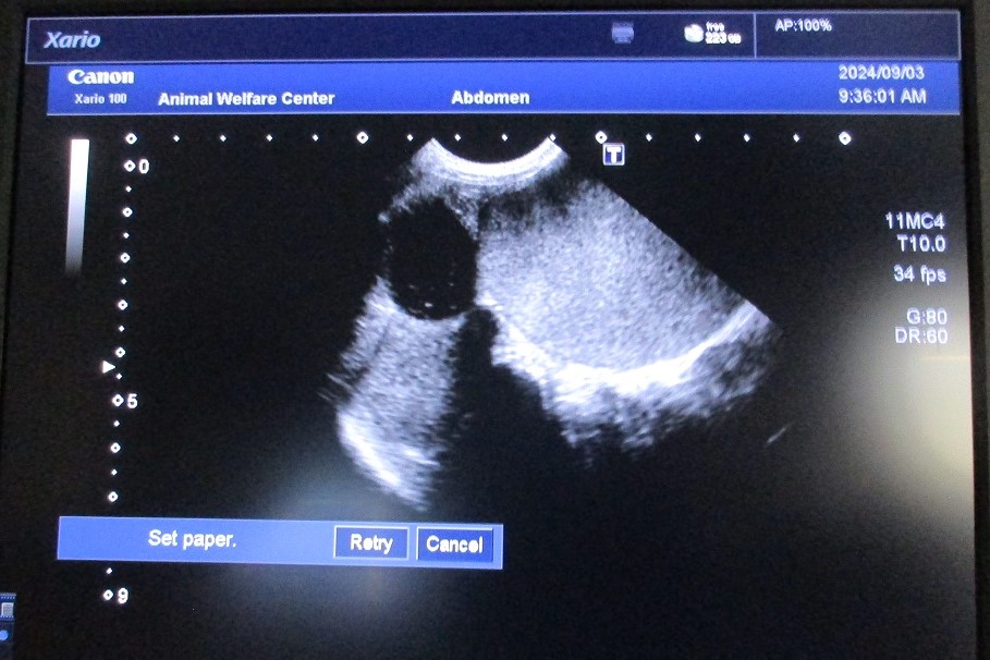 写真：治療前の子宮エコー